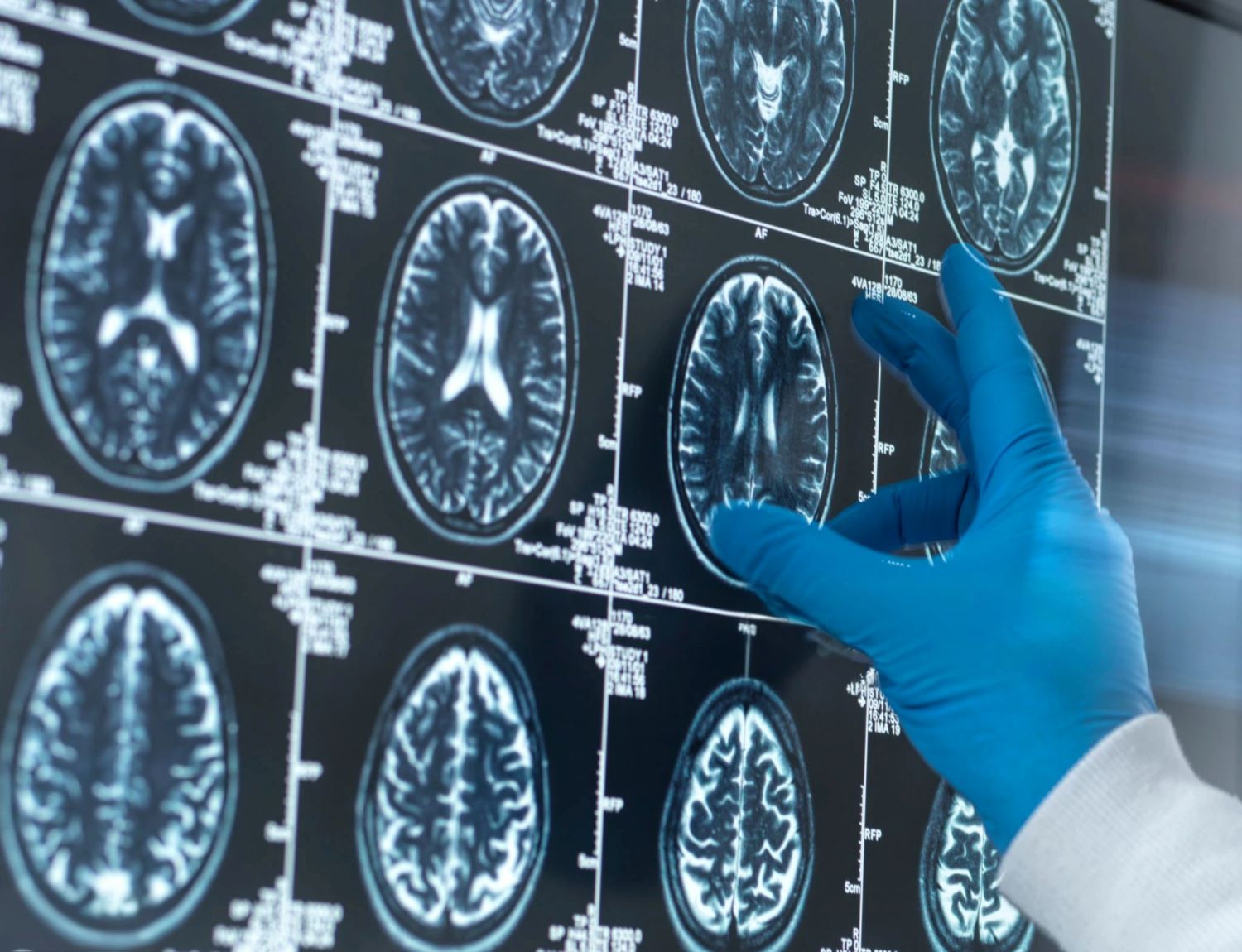 Montana Concussion Symposium 2026 Updates Banner